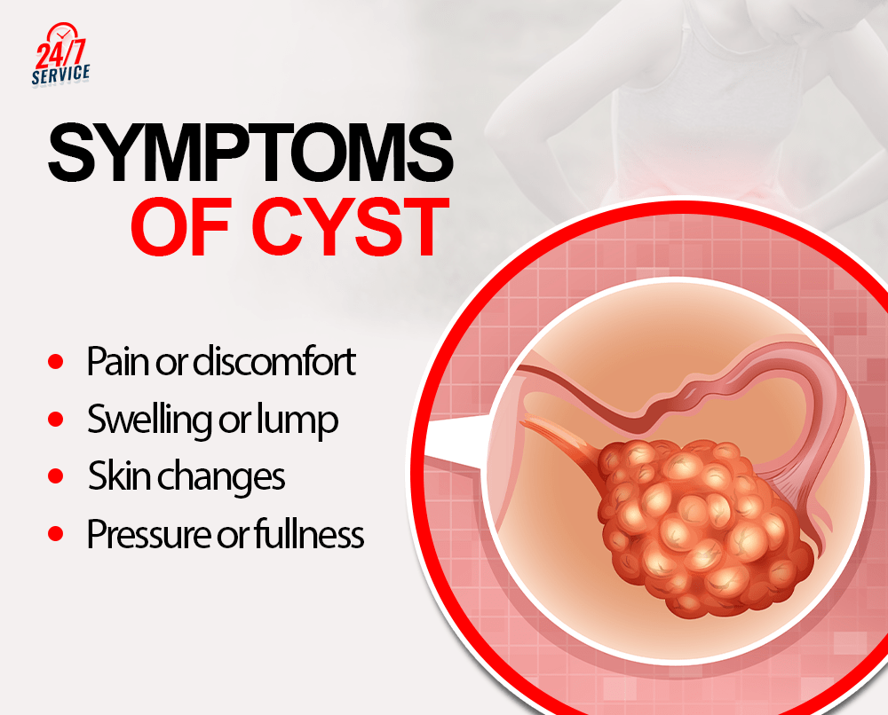 cyst treatment in chandigarh