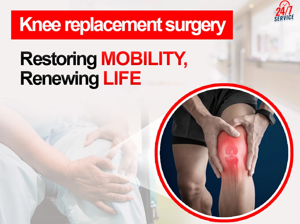 Knee Replacement Surgery