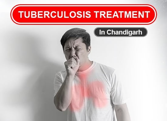 Tuberculosis Treatment in Chandigarh