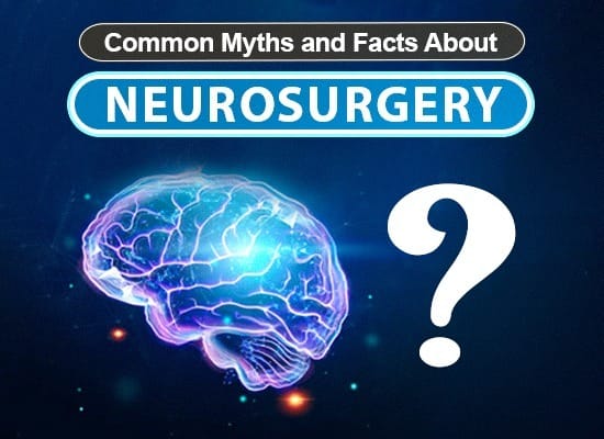 myths-and-facts-about-neurosurgery